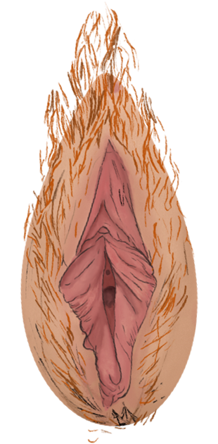 valvus